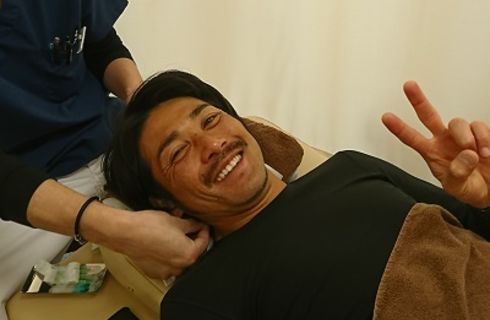 男性にも美容鍼
