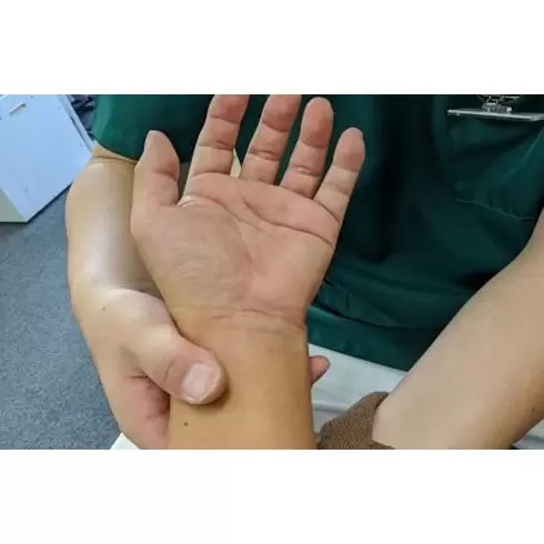 神経痛の治療