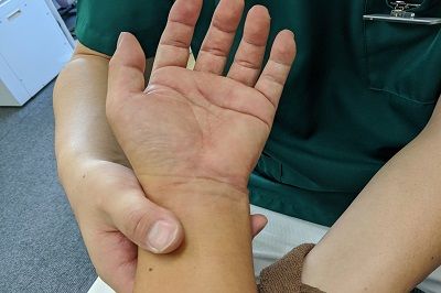手首の捻挫