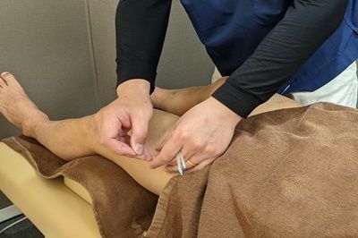 膝に鍼治療