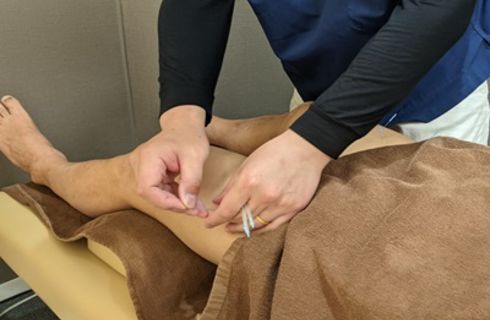 ひざ痛に鍼治療