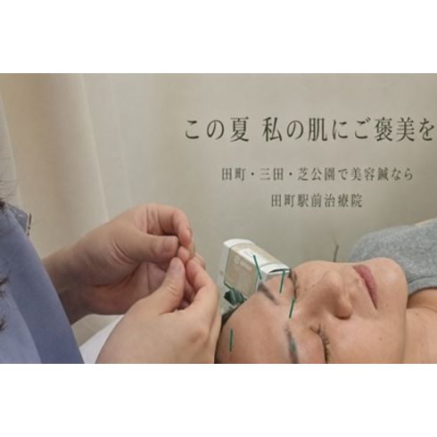 美容鍼