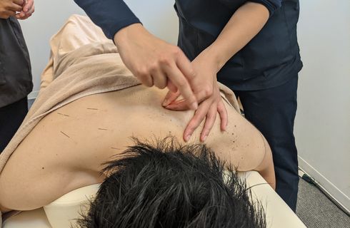 鍼治療を中心に患部にアプローチ
